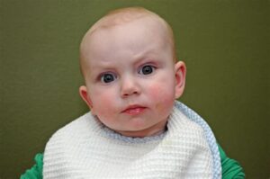Baby irritated