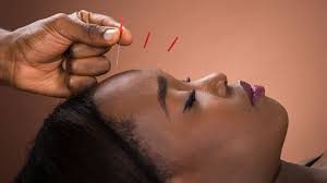 Acupuncture would be considered 4D Healing.